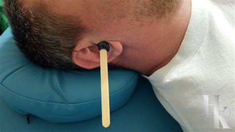 Ear wax removal sparks nv  Usually, excess wax is removed from the ear canal naturally when a small amount of wax accumulates and then dries up and falls out of the ear canal, carrying